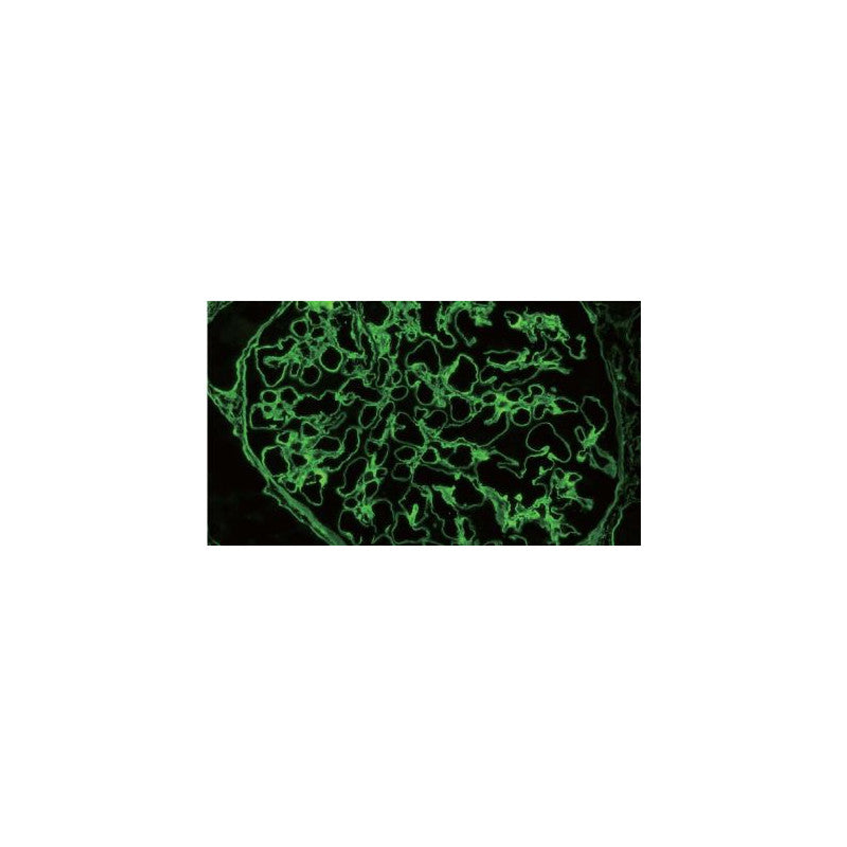 Microscope à fluorescence trinoculaire CX43 LED sans objectifs - Evident Olympus