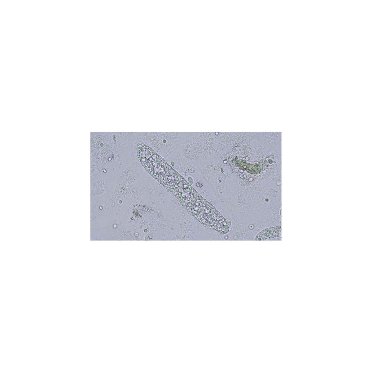 Microscope à fluorescence trinoculaire CX43 LED sans objectifs - Evident Olympus
